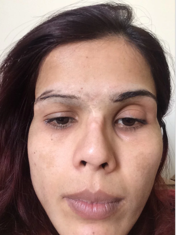 Dr Sadaf Saeed Plastic Surgeon In Karachi